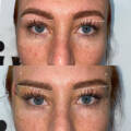 Cat Eye draadlift: alles wat je moet weten